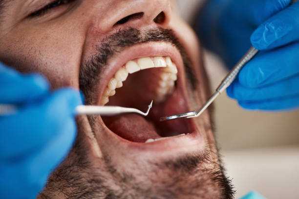 Best Cosmetic Emergency Dentistry in Fish Hawk, FL